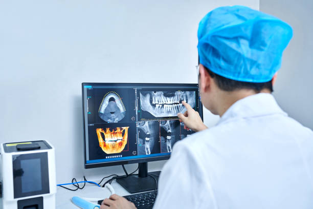 Best Emergency Dentist for Lost Fillings or Crowns in Fort Oglethorpe, GA